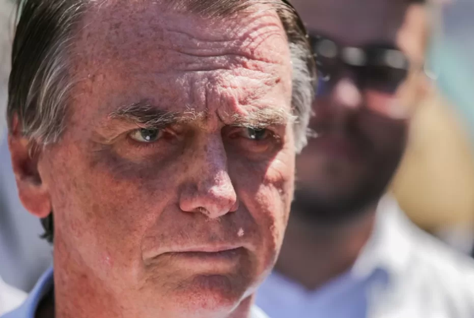 Bolsonaro mostra cicatrizes na barriga ao deixar hospital no DF
