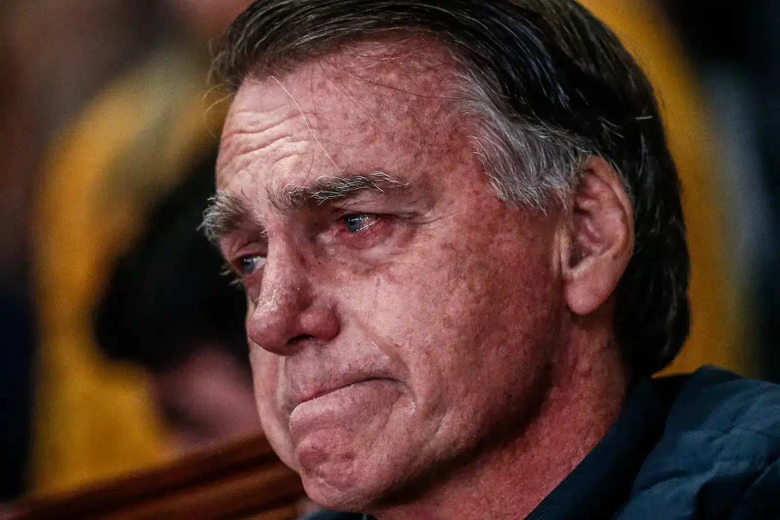 Bolsonaro adoece no pior momento: soluços retornam em meio a risco iminente de prisão