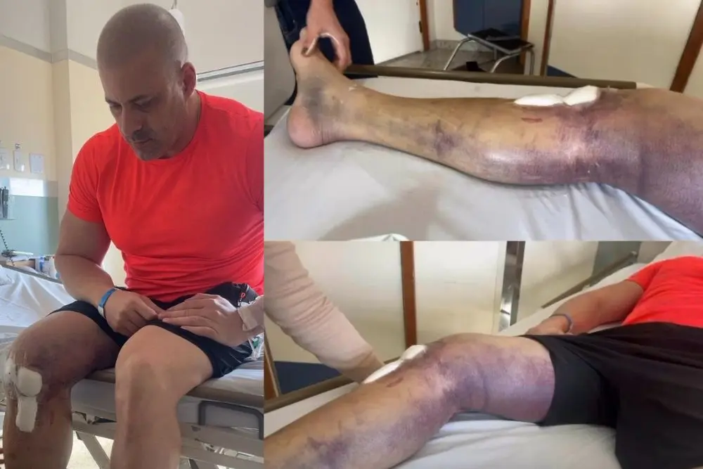 Moraes exige explicações de Daniel Silveira por não voltar à prisão após fisioterapia