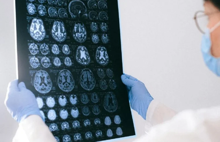 Reinicialização cerebral: Alzheimer é revertido em camundongos com tratamento inovador, apontam cientistas