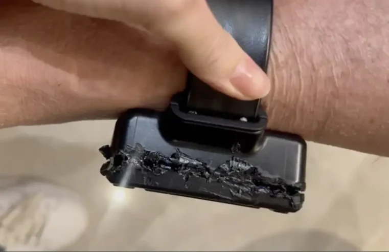 Bolsonaro admite que “meteu ferro quente” na tornozeleira e escancara plano de fuga