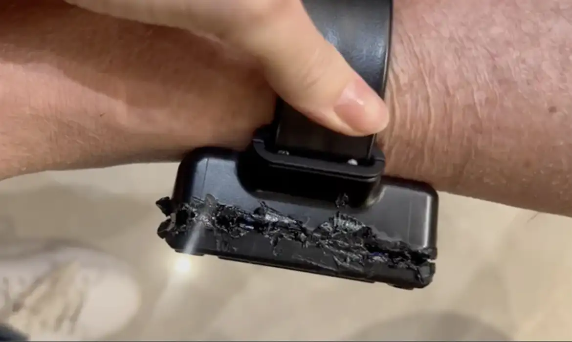 Bolsonaro admite que “meteu ferro quente” na tornozeleira e escancara plano de fuga