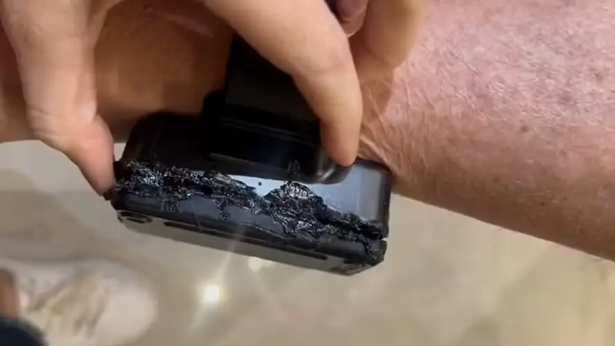 Defesa de Bolsonaro pede laudo médico e afirma que surto provocou violação da tornozeleira